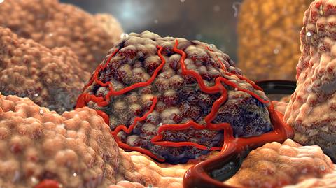 3d,Tumor,Cell,With,Vessels,Illustration