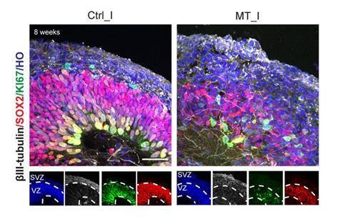 Studying brain organoids