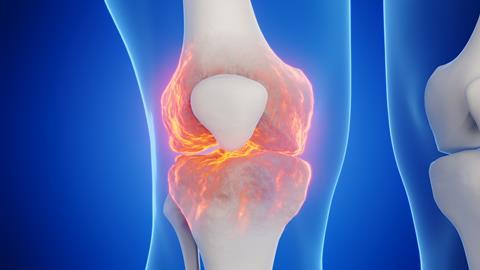 3d,Rendered,Medical,Illustration,Of,A,Man's,Knee.,Blue,Background.