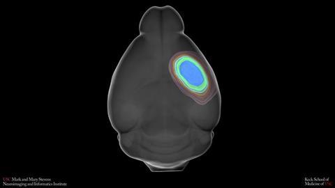 Low-Res_2026-07-29-SPAN-Lesion-Data-For-Jim_composite_V4__0005