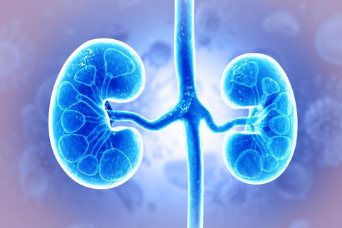 Human,Kidney,Medical,Diagram,,Anatomy,Of,The,Kidney,,Diseased,Kidney.