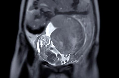 Mri,During,Pregnancy,Ensures,Non-invasive,Evaluation,Of,Fetal,Health,,Maternal