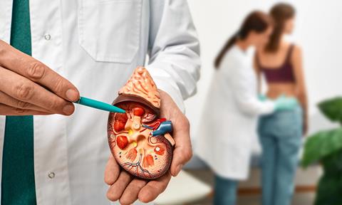 kidney-disease-image