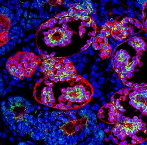 Low-Res_Kidney Organoid