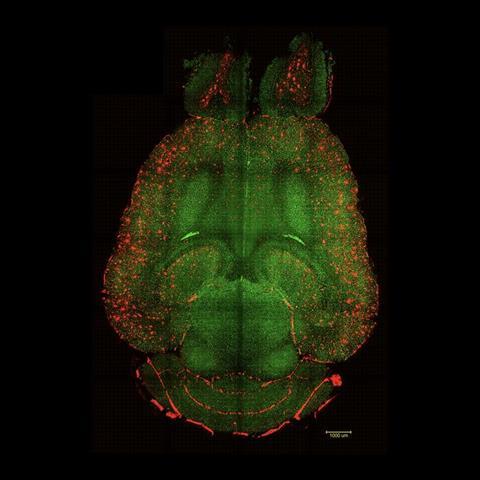 Non treated mouse brain
