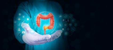 Colon,Cancer,Concept.,The,Doctor,Analyzes,The,Large,Intestine,With