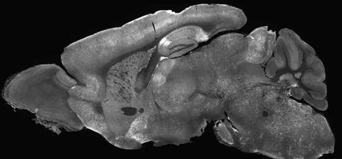 Low-Res_Syngap1 brain for Article
