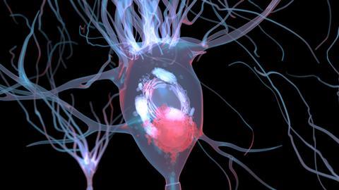 Lewy,Body,In,Neuron,Affected,By,Parkinson's,Disease