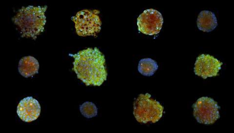 cell painting_uppsala_university_3D_cancer_cell_clusters