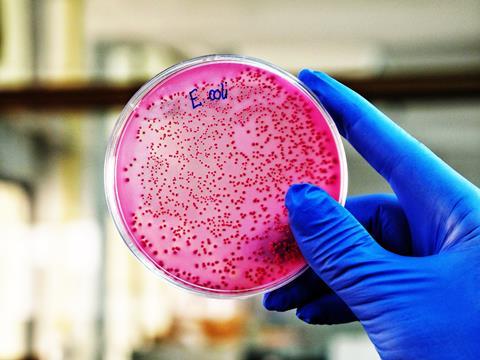 A,Scientist,Is,Holding,A,Plate,Of,E.,Coli,Growing