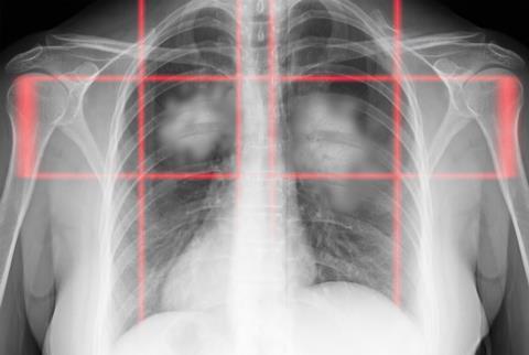 shutterstock_2437936285