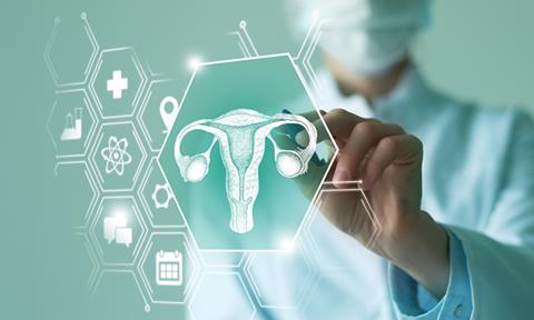 ovarian-cancer-image