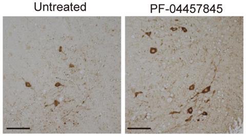 Low-Res_fig5_E_JCIinsight&nbsp;_revised