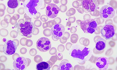white-blood-cells-image