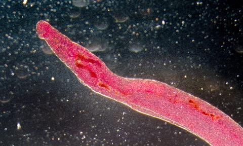 schistosomiasis-image