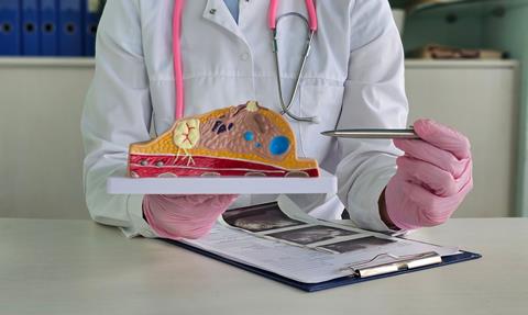 A,Doctor,Showing,A,Breast,Tumor,Or,Cancer,On,An