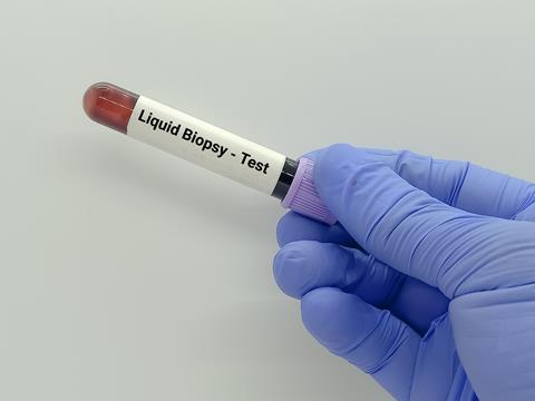 Doctor,Holds,Blood,Sample,For,Liquid,Biopsy,Test,To,Detect