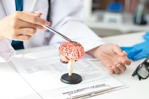 Alzheimer's,Disease,Asian,Female,Doctor,Holds,Brain,Anatomy,Model,For