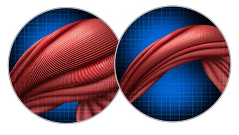 Cancer,Cachexia,As,Appetite,Reduction,And,Not,Eating,Enough,Due