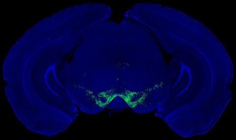 Low-Res_Dopamine Parkinsons pic (1)