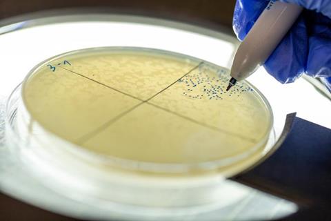 Low-Res_Counting phage plaques on an E. coli culture Credit Yosef Adest