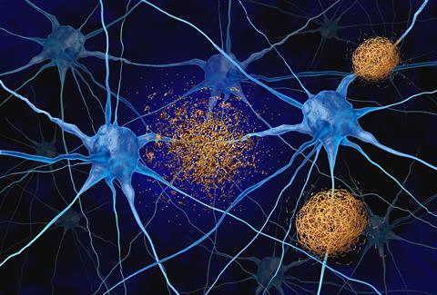 Amyloid,Targeted,Therapy,As,Plaques,Made,Of,Abnormal,Clusters,Of