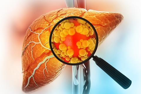 Magnifying,Glass,Showing,The,Diseased,Liver.,Virus,Infected,Liver.,3d