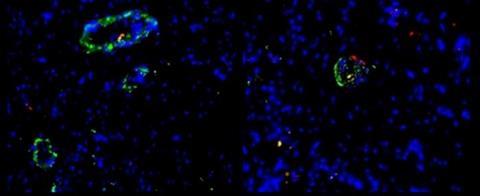 Low-Res_Image for Vas Organoids
