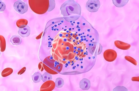 Triple-negative,Breast,Cancer,(tnbc),-,Closeup,View,3d,Illustration