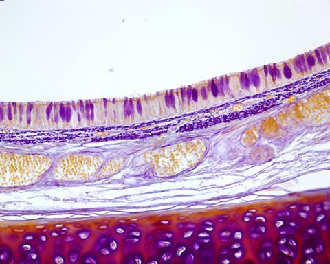 Tracheal,Mucosa,Lined,By,Ciliated,Pseudostratified,Prismatic,Epithelium,With,Goblet
