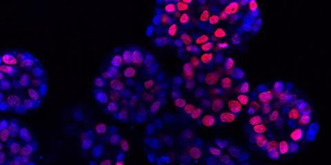 Low-Res_Leberkrebs-Organoide 1000x500
