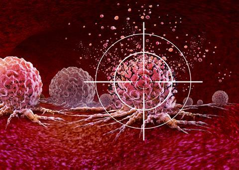 Ultrasound,Cancer,Treatment,And,New,Cancer,Killing,Tumours,Therapy,With