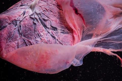 Placenta,With,Veins,,Cord,And,Amnion