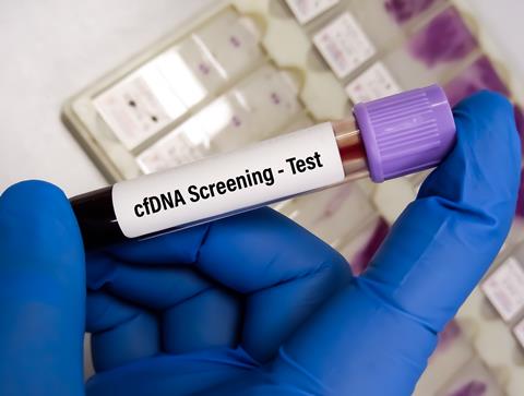 Blood,Sample,For,Prenatal,Cfdna,(cell-free,Dna),Screening,Test,For
