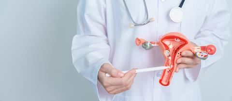 Doctor,Holding,Uterus,And,Ovaries,Model.,Ovarian,And,Cervical,Cancer,