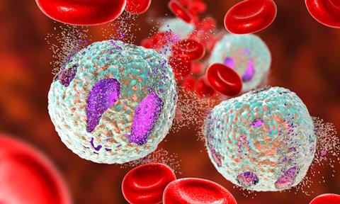 Close-up,View,Of,A,Microscope,Slide,Showing,Acute,Lymphoblastic,Leukemia