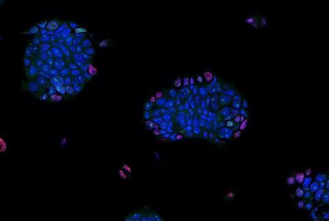 Low-Res_organoid