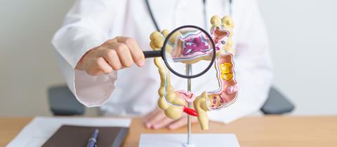 Doctor,With,Human,Colon,Anatomy,Model,And,Magnifying,Glass.,Colonic