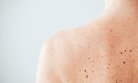 melanin-production-image