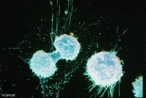 Low-Res_ovarian cancer image