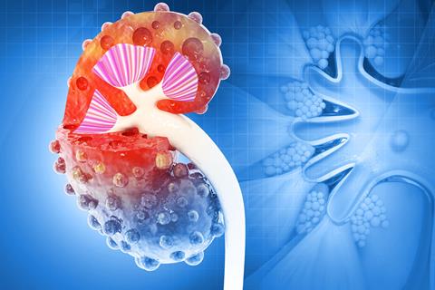 Chronic,Kidney,Disease,On,Scientific,Background.,Cross,Section.,3d,Illustration