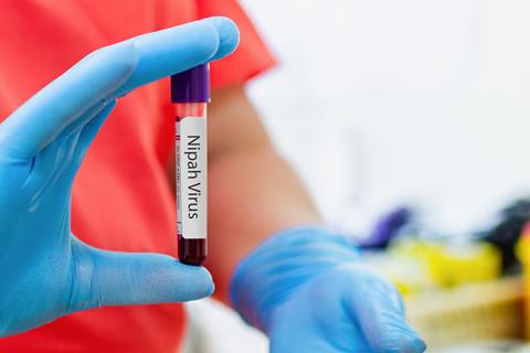 Nipah,Virus,Concept.womans,Hand,Holding,A,Glass,Test,Tube.nipah,Henipavirus