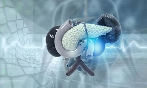 pancreatic-cancer-image