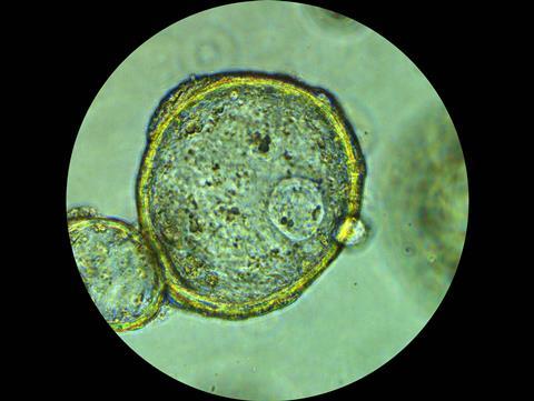 Microscope image showing a three-dimensional organoid structure.