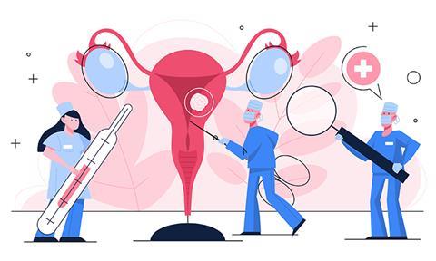 ovarian-cancer-image